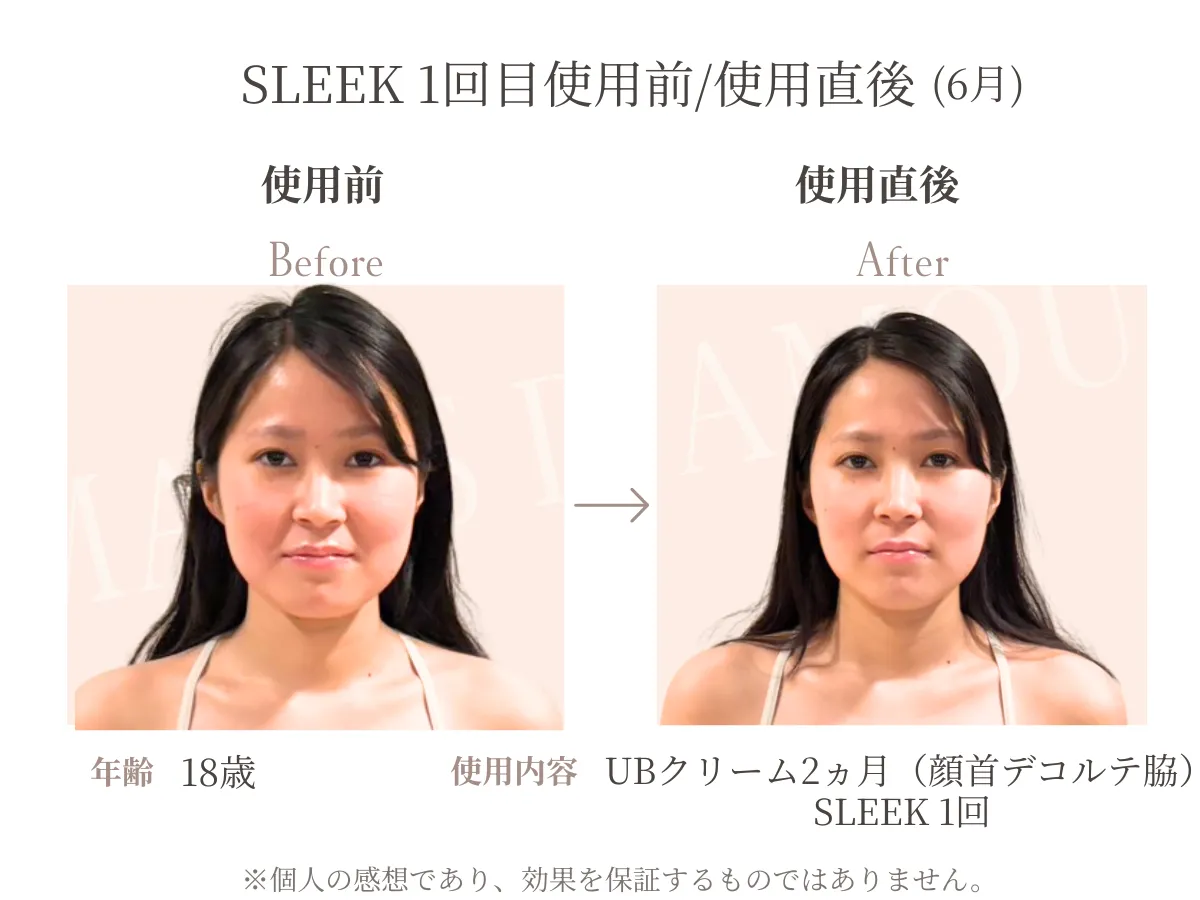 10代女性がSLEEKを初回使用した前後の比較