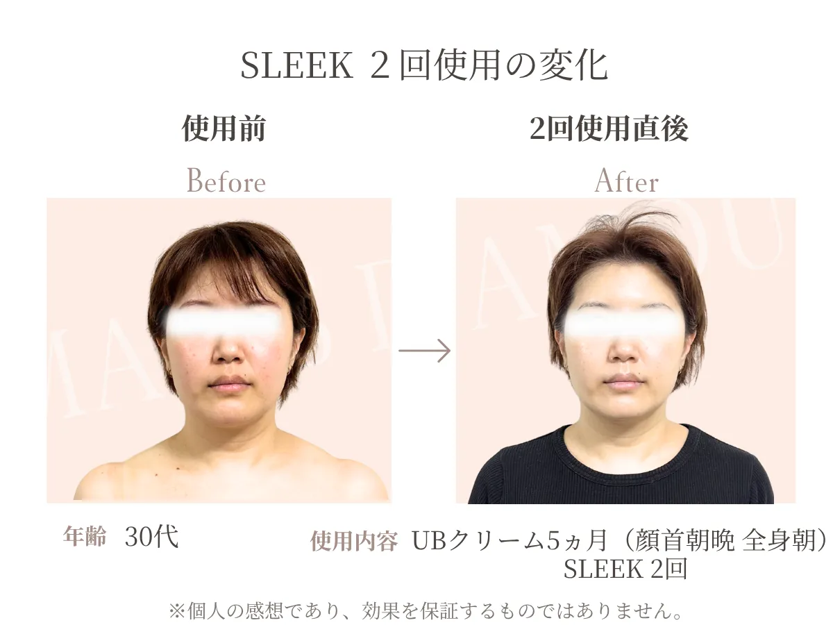 30代女性がSLEEKを2回使用した前後の比較