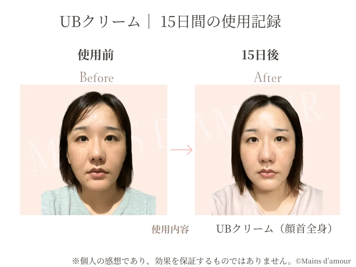 40代女性がUBクリームを顔と首へ使用する前と15日後の比較
