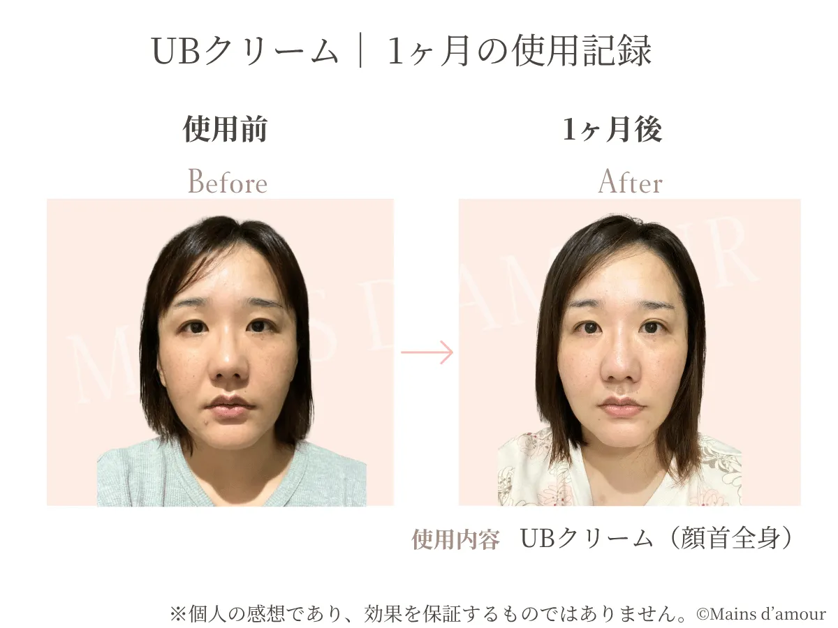 40代女性がUBクリームを顔・首・全身に使用した1か月間の記録