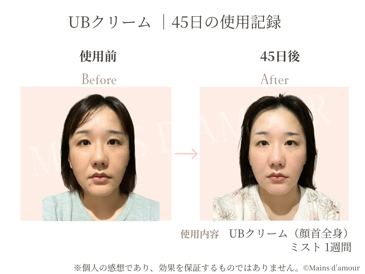 40代女性の顔と首の使用前と45日後の比較