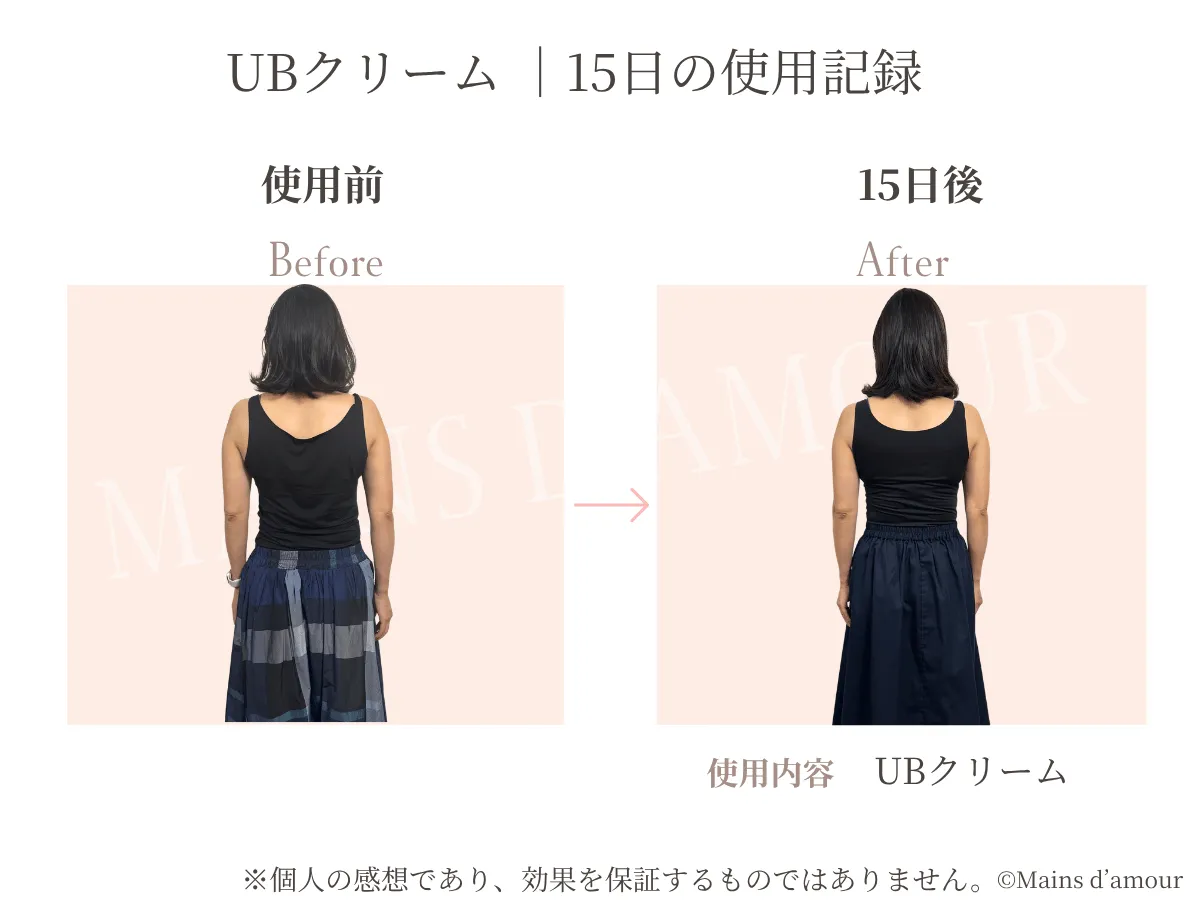 40代女性がUBクリームを上半身に15日間使用した前後の比較