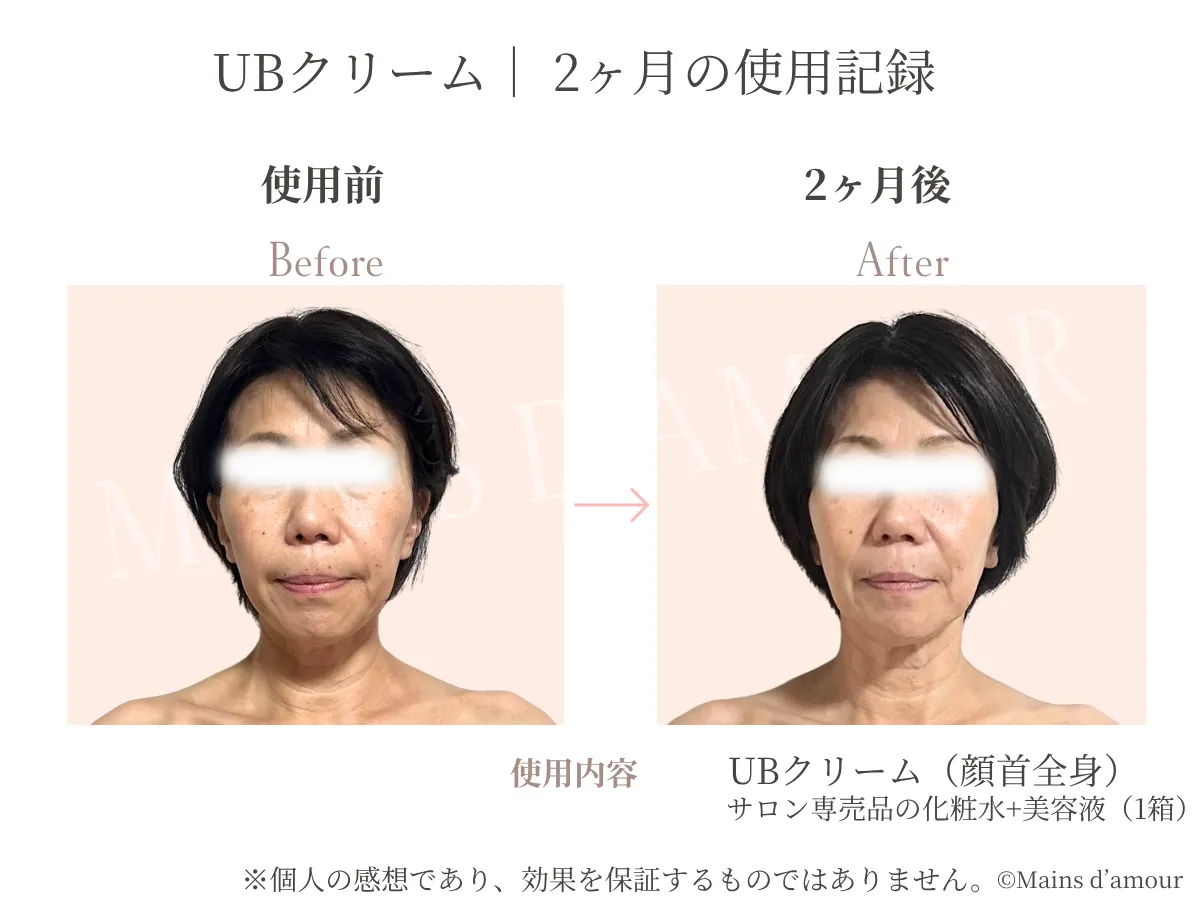 50代女性がUBクリームとケア商品を2か月間使用した顔の比較