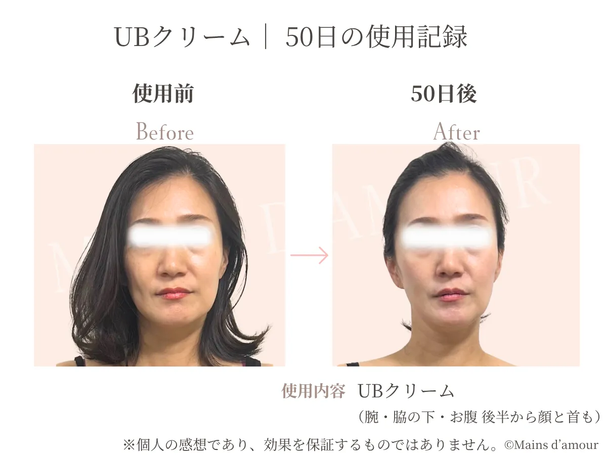 40代女性がUBクリームを顔に20日間使用した前後の比較