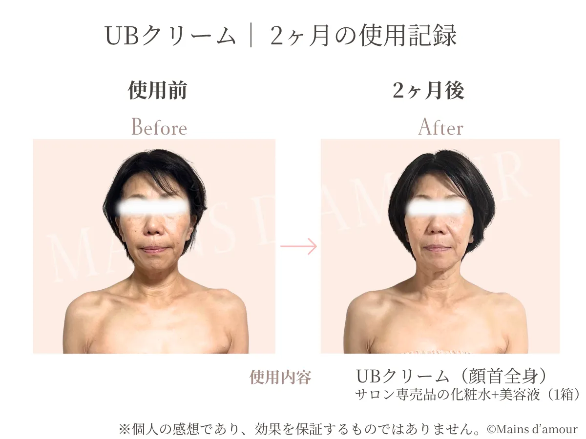 50代女性がUBクリームとケア商品を2か月間使用した上半身の比較