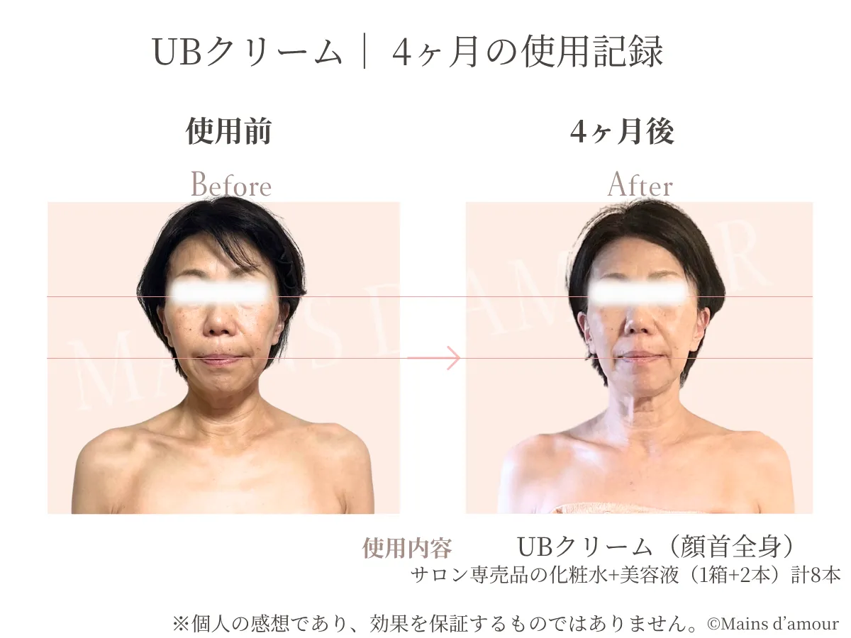 50代女性の上半身4か月間の比較 補助線入り