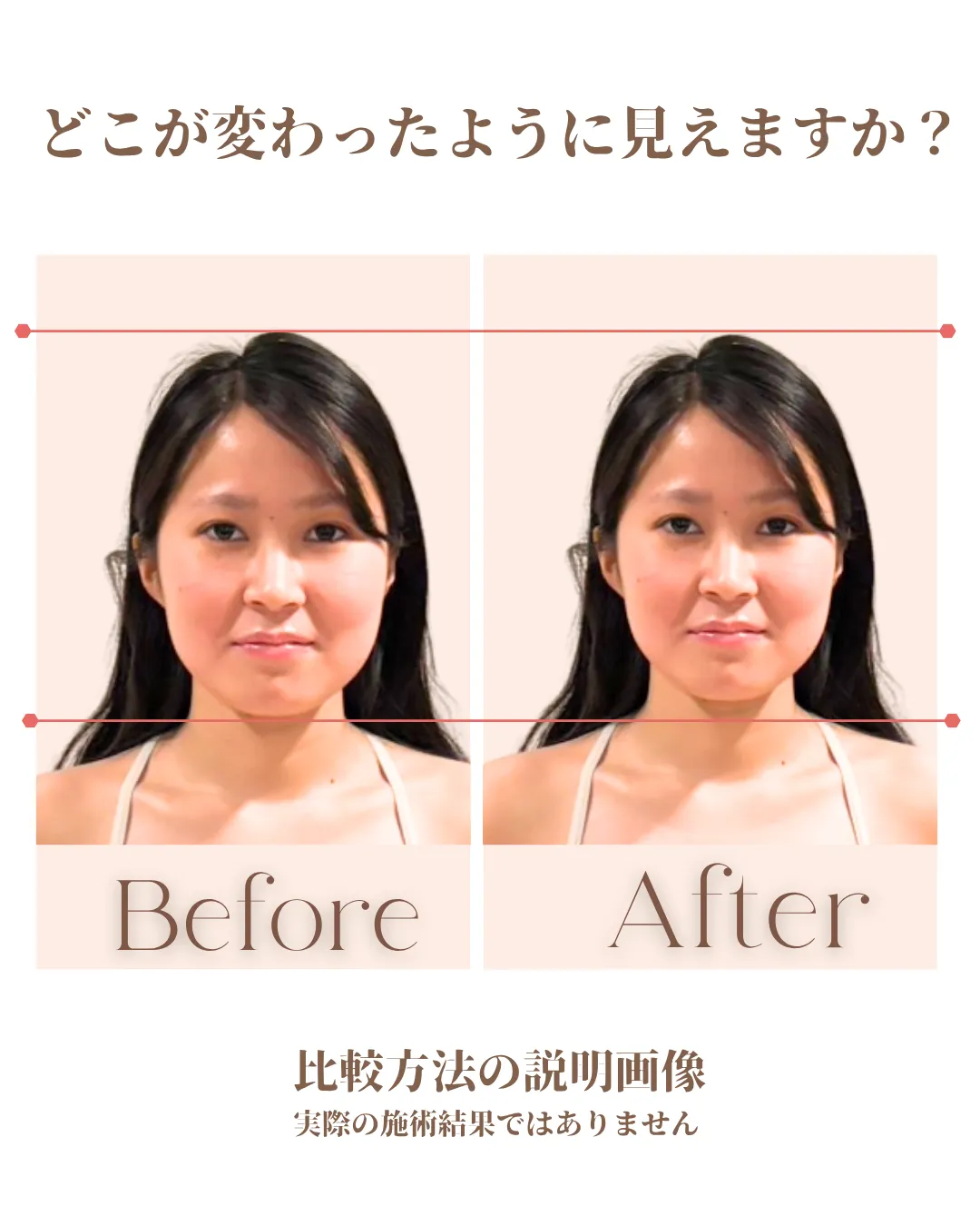 Before／After写真のどこが変わったように見えるかを問う説明画像